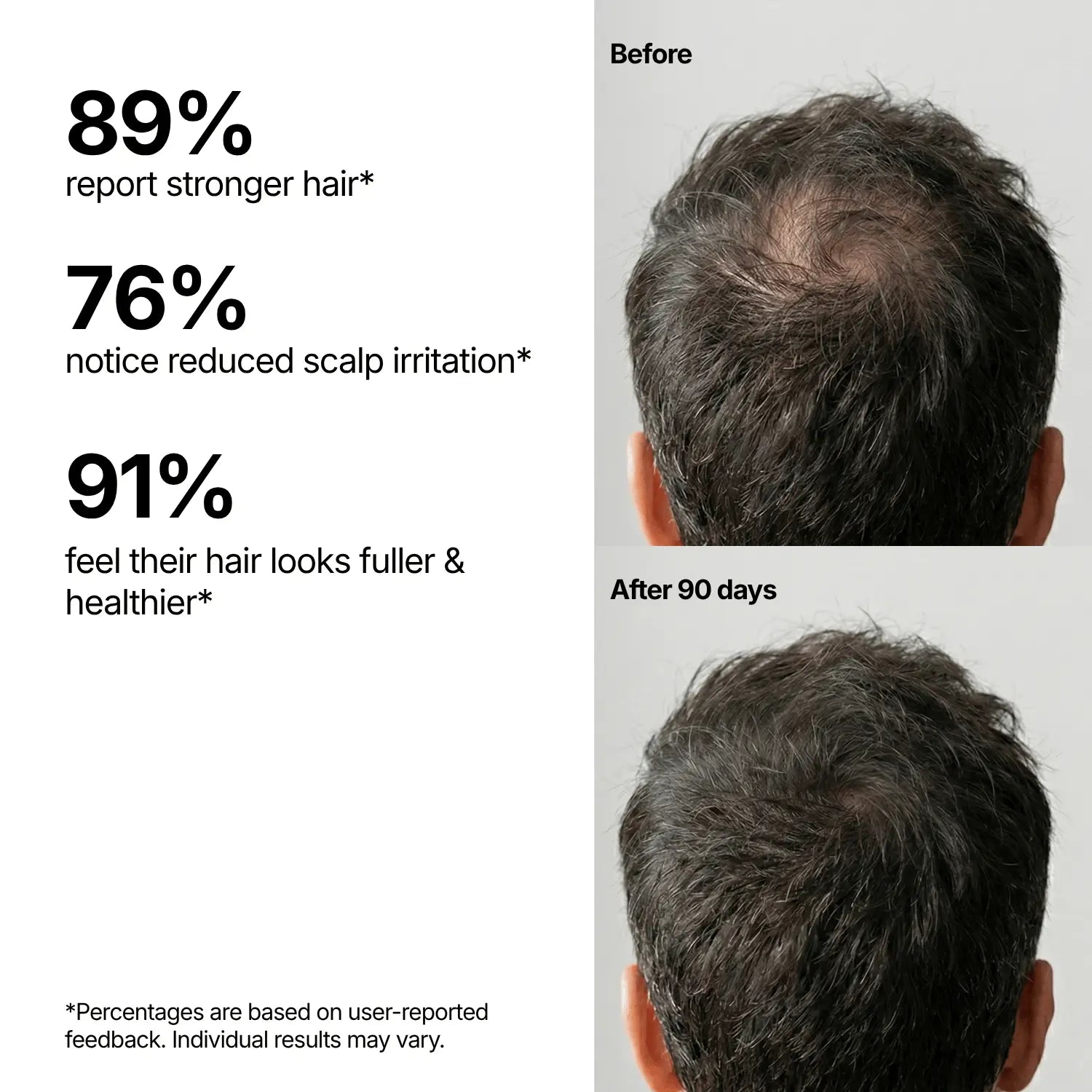 Hair Preservation Shampoo
