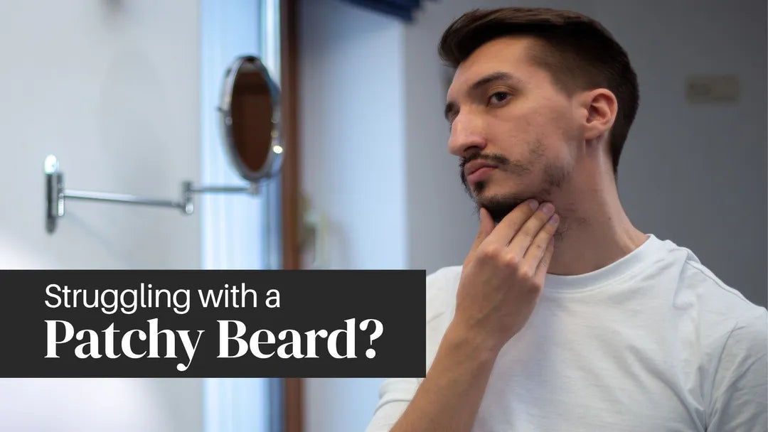 Patchy beard