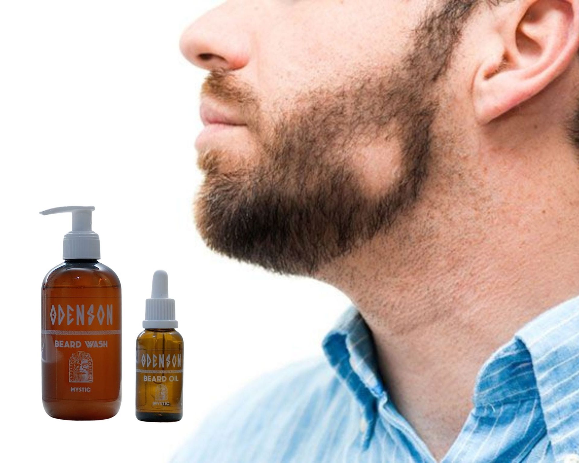 Alopecia Your Beard's Worst Nightmare Odenson