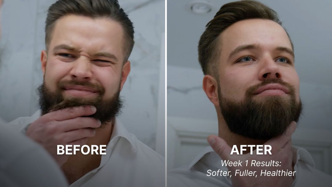 Beard transformation from using oil
